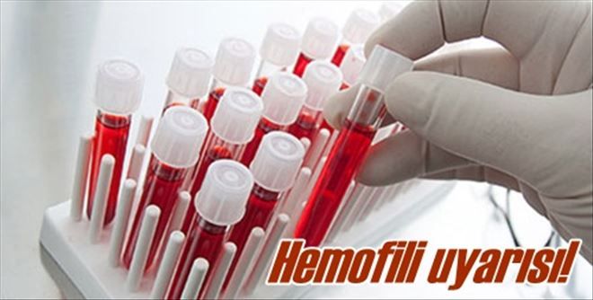 Hemofili kalıtsal bir hastalıktır