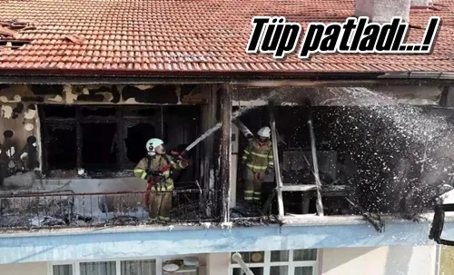 Tüp patladı…!