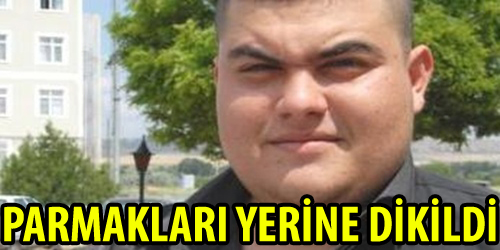 Parmaklarını Kaybetmedi